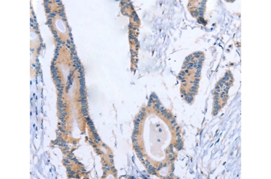 Immunohistochemistry - BOD1 Antibody from Signalway Antibody (37445) - Antibodies.com