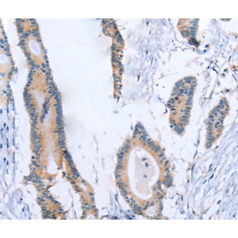 Immunohistochemistry - BOD1 Antibody from Signalway Antibody (37445) - Antibodies.com