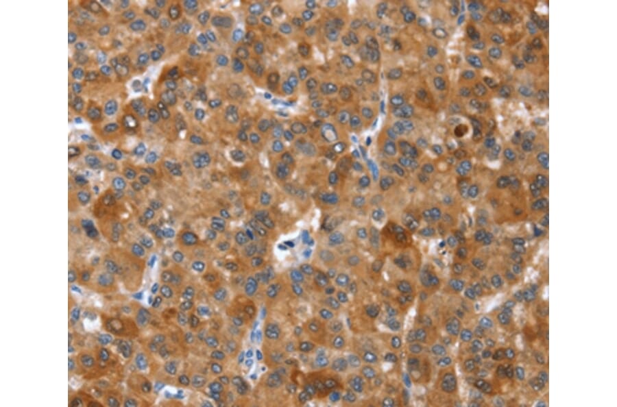 Immunohistochemistry - NOD2 Antibody from Signalway Antibody (37460) - Antibodies.com