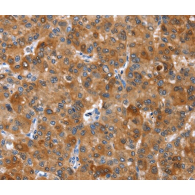 Immunohistochemistry - NOD2 Antibody from Signalway Antibody (37460) - Antibodies.com