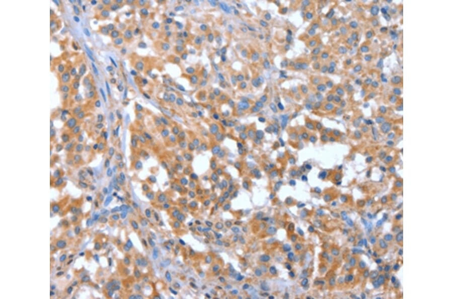 Immunohistochemistry - NOD2 Antibody from Signalway Antibody (37460) - Antibodies.com