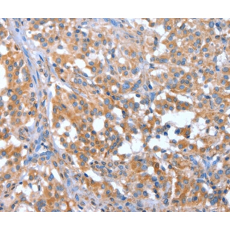 Immunohistochemistry - NOD2 Antibody from Signalway Antibody (37460) - Antibodies.com