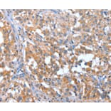 Immunohistochemistry - NOD2 Antibody from Signalway Antibody (37460) - Antibodies.com