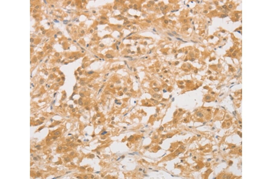 Immunohistochemistry - CD24 Antibody from Signalway Antibody (37467) - Antibodies.com