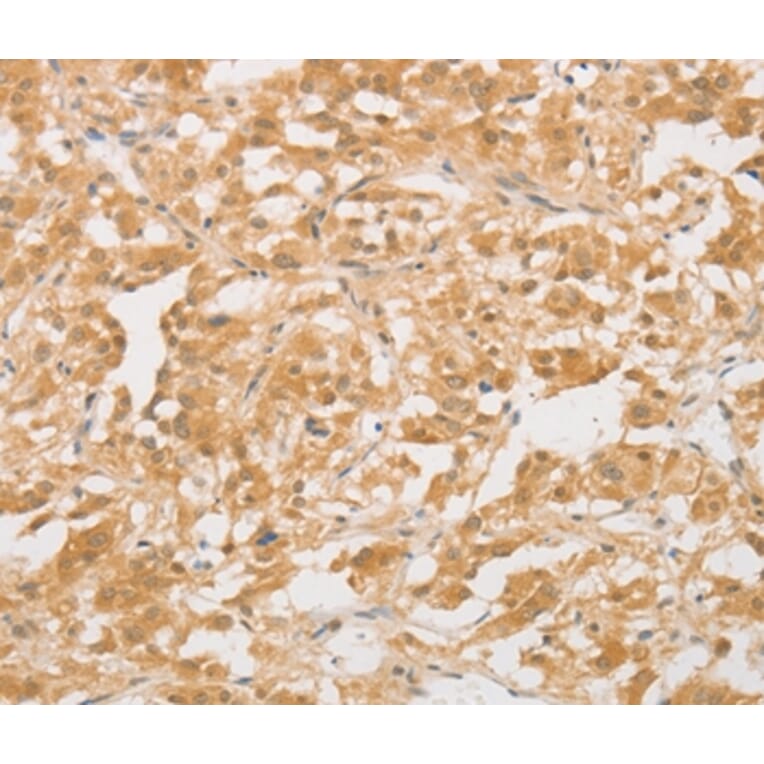 Immunohistochemistry - CD24 Antibody from Signalway Antibody (37467) - Antibodies.com