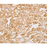 Immunohistochemistry - CD24 Antibody from Signalway Antibody (37467) - Antibodies.com