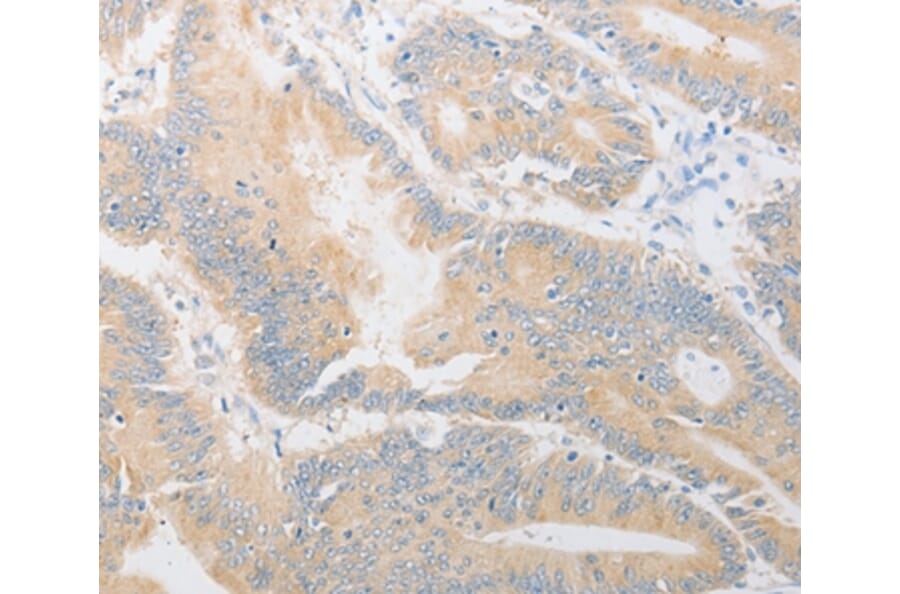Immunohistochemistry - CD24 Antibody from Signalway Antibody (37467) - Antibodies.com