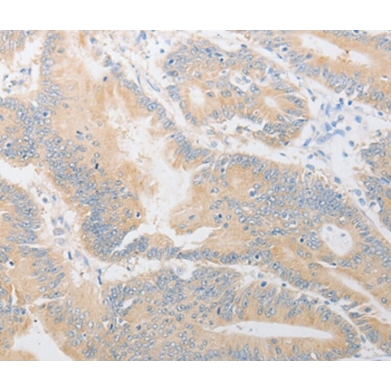 Immunohistochemistry - CD24 Antibody from Signalway Antibody (37467) - Antibodies.com