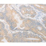 Immunohistochemistry - CD24 Antibody from Signalway Antibody (37467) - Antibodies.com