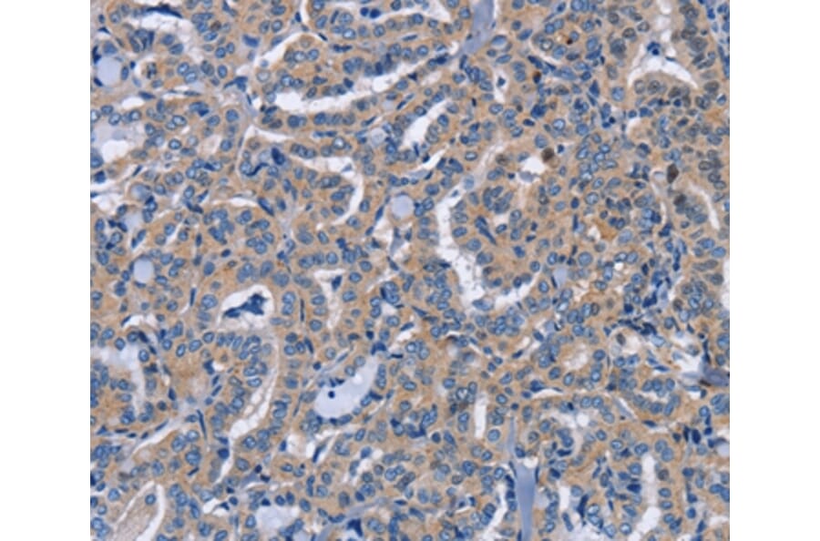 Immunohistochemistry - NCR2 Antibody from Signalway Antibody (37472) - Antibodies.com