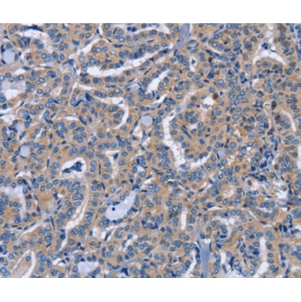 Immunohistochemistry - NCR2 Antibody from Signalway Antibody (37472) - Antibodies.com