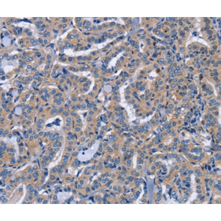 Immunohistochemistry - NCR2 Antibody from Signalway Antibody (37472) - Antibodies.com