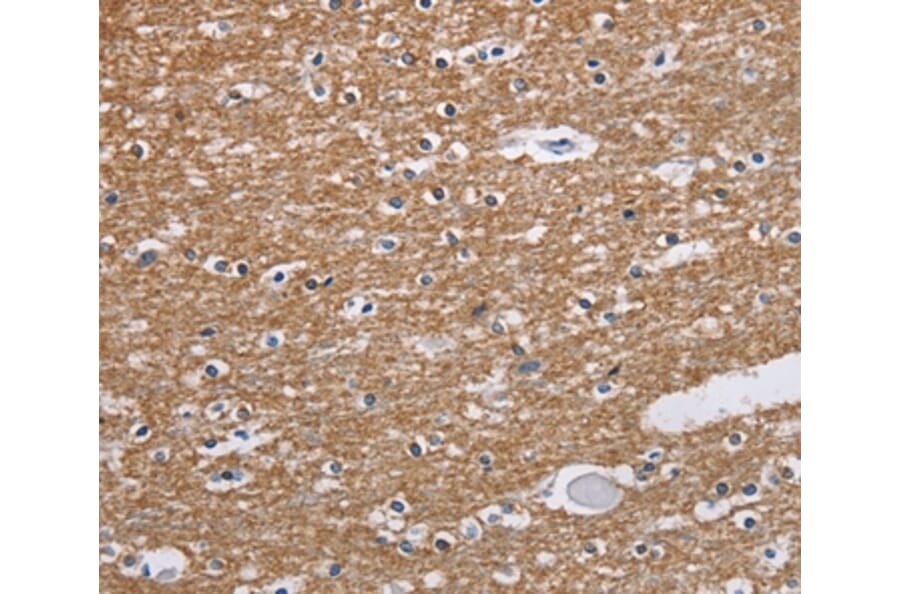 Immunohistochemistry - NCR2 Antibody from Signalway Antibody (37472) - Antibodies.com