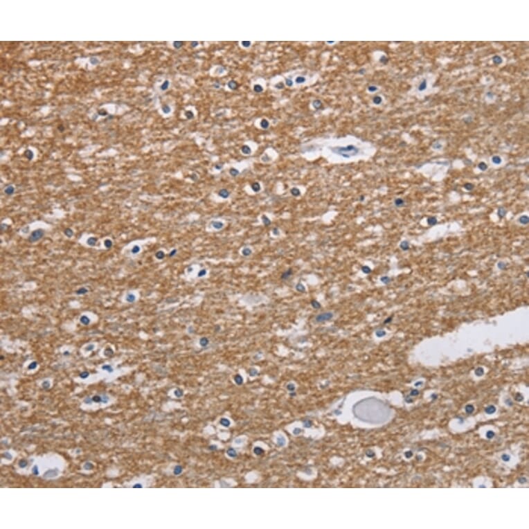 Immunohistochemistry - NCR2 Antibody from Signalway Antibody (37472) - Antibodies.com
