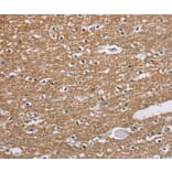 Immunohistochemistry - NCR2 Antibody from Signalway Antibody (37472) - Antibodies.com