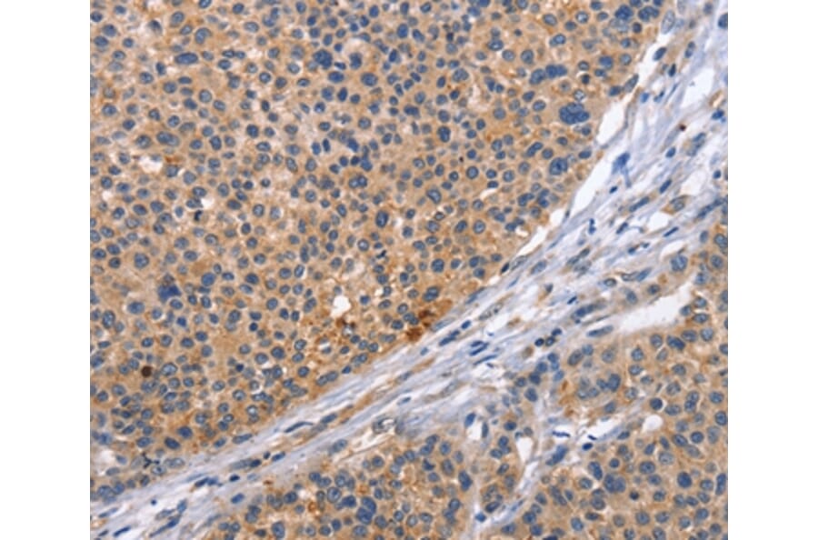 Immunohistochemistry - CD5L Antibody from Signalway Antibody (37478) - Antibodies.com
