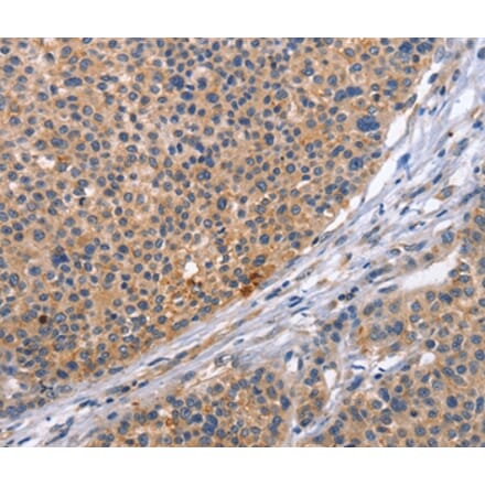 Immunohistochemistry - CD5L Antibody from Signalway Antibody (37478) - Antibodies.com
