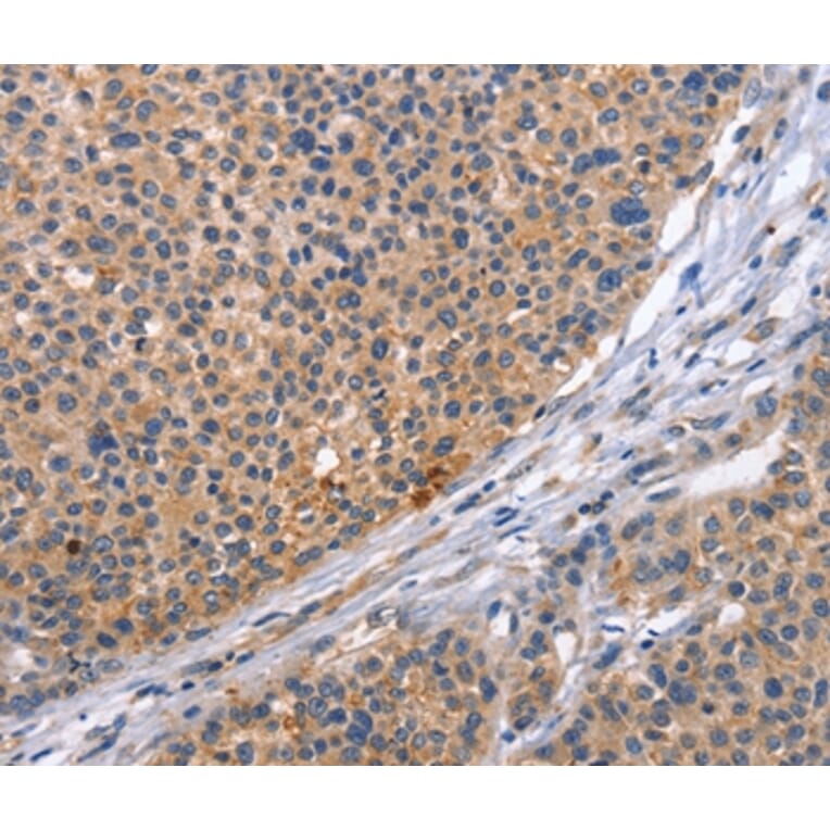Immunohistochemistry - CD5L Antibody from Signalway Antibody (37478) - Antibodies.com
