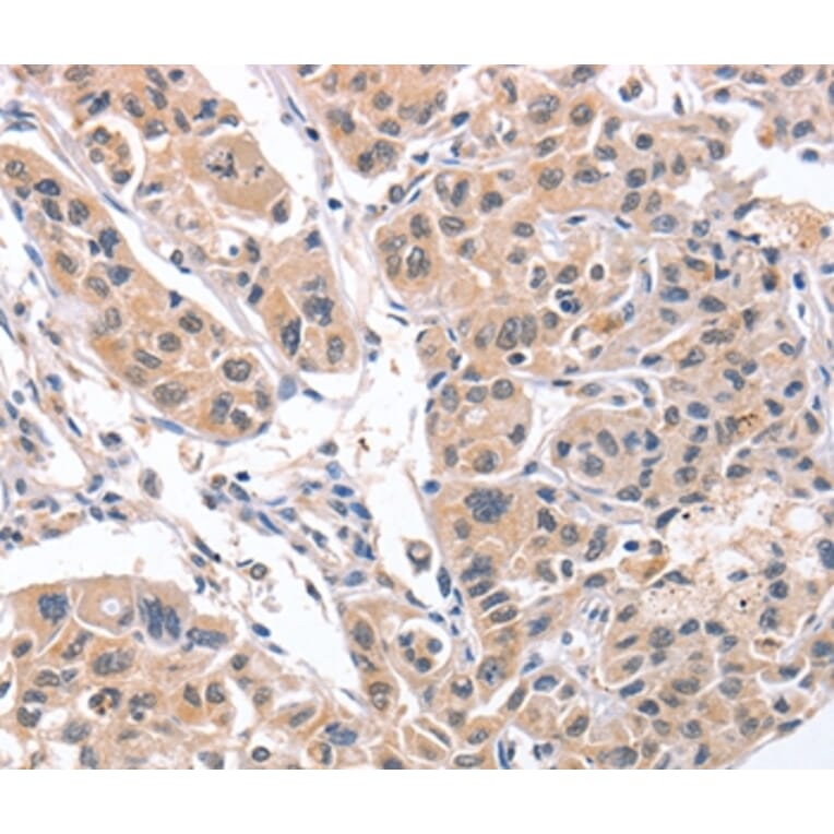 Immunohistochemistry - CD5L Antibody from Signalway Antibody (37478) - Antibodies.com