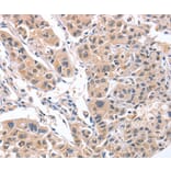 Immunohistochemistry - CD5L Antibody from Signalway Antibody (37478) - Antibodies.com