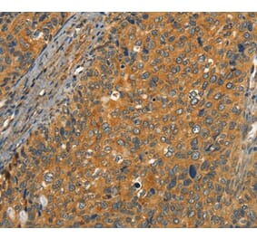 Immunohistochemistry - CIB1 Antibody from Signalway Antibody (37488) - Antibodies.com