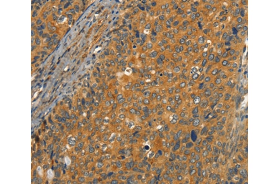 Immunohistochemistry - CIB1 Antibody from Signalway Antibody (37488) - Antibodies.com