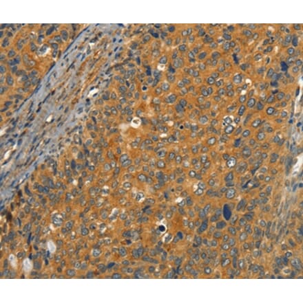 Immunohistochemistry - CIB1 Antibody from Signalway Antibody (37488) - Antibodies.com