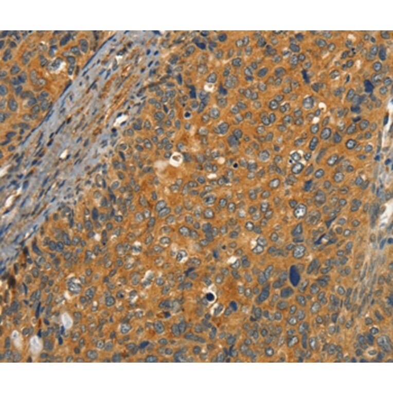 Immunohistochemistry - CIB1 Antibody from Signalway Antibody (37488) - Antibodies.com
