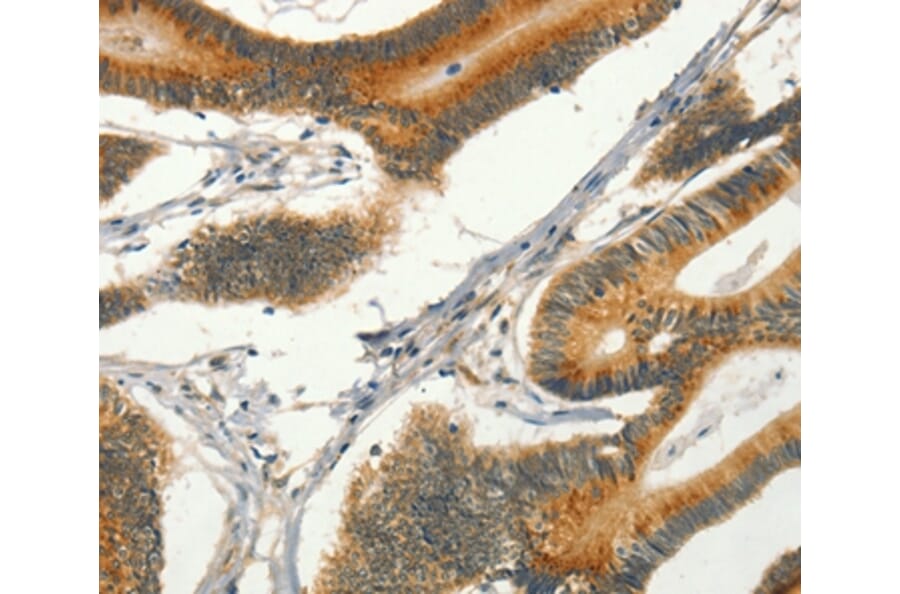 Immunohistochemistry - CIB1 Antibody from Signalway Antibody (37488) - Antibodies.com