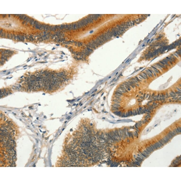 Immunohistochemistry - CIB1 Antibody from Signalway Antibody (37488) - Antibodies.com
