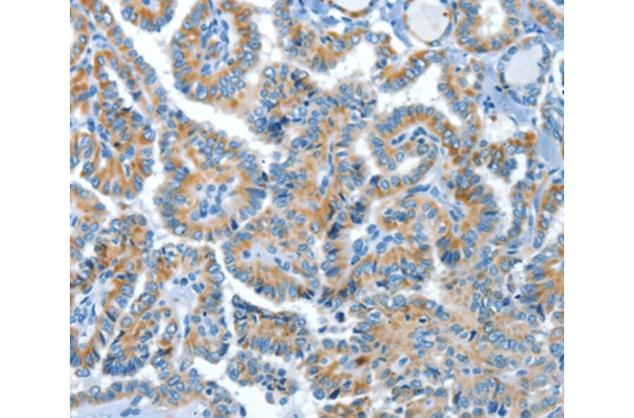 Immunohistochemistry - COG1 Antibody from Signalway Antibody (37495) - Antibodies.com