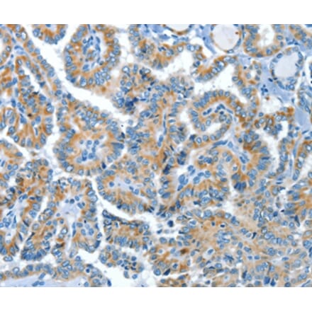 Immunohistochemistry - COG1 Antibody from Signalway Antibody (37495) - Antibodies.com