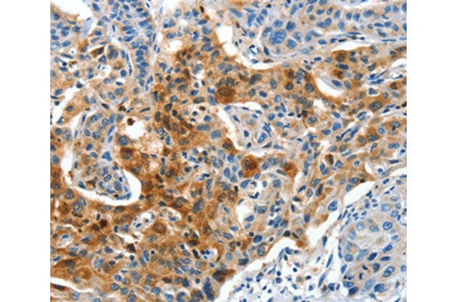 Immunohistochemistry - COG1 Antibody from Signalway Antibody (37495) - Antibodies.com