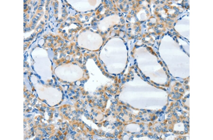 Immunohistochemistry - HID1 Antibody from Signalway Antibody (37500) - Antibodies.com