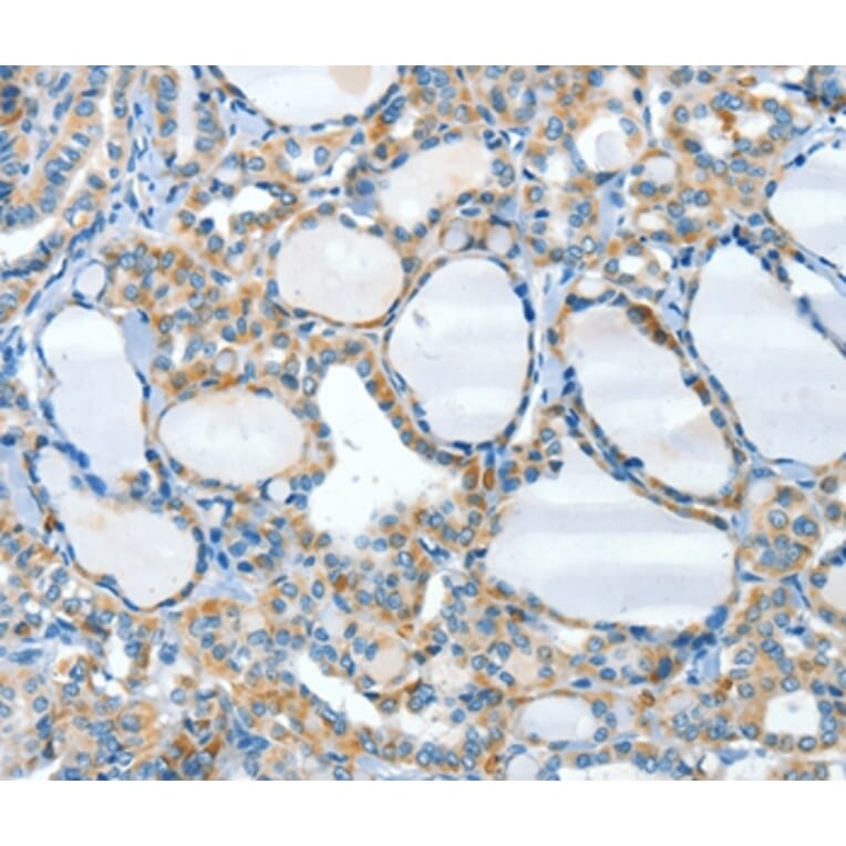 Immunohistochemistry - HID1 Antibody from Signalway Antibody (37500) - Antibodies.com