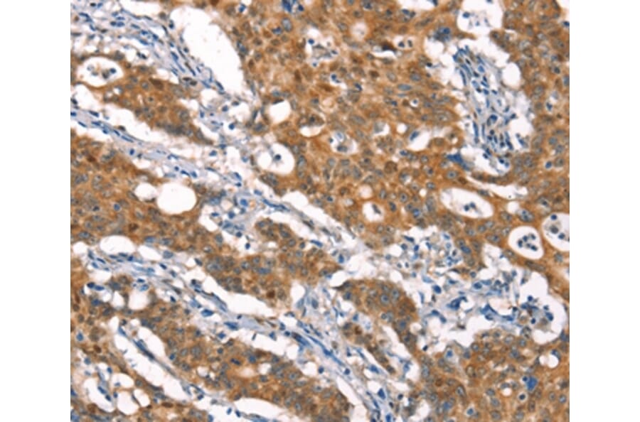 Immunohistochemistry - CYLD Antibody from Signalway Antibody (37514) - Antibodies.com