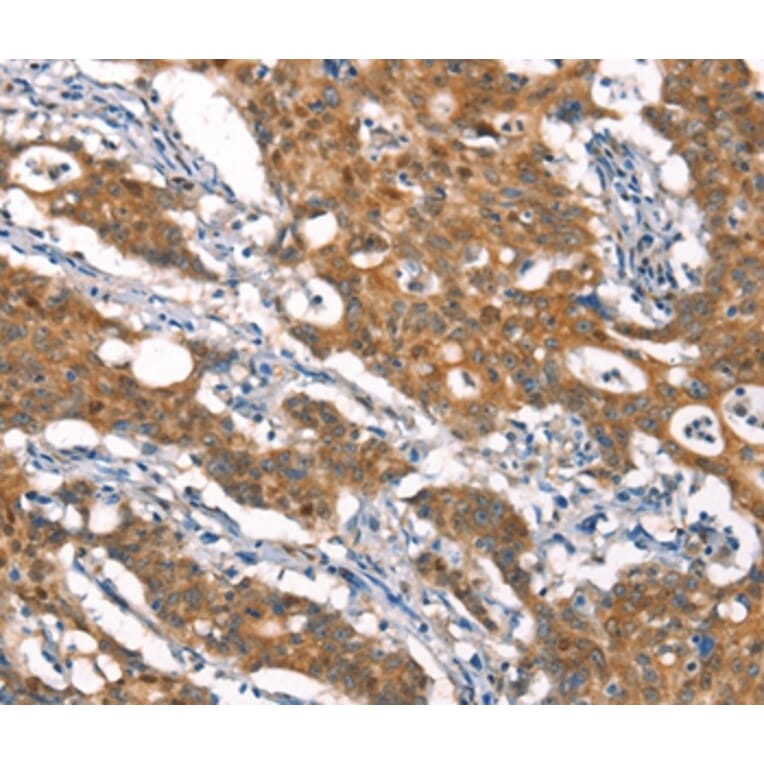 Immunohistochemistry - CYLD Antibody from Signalway Antibody (37514) - Antibodies.com