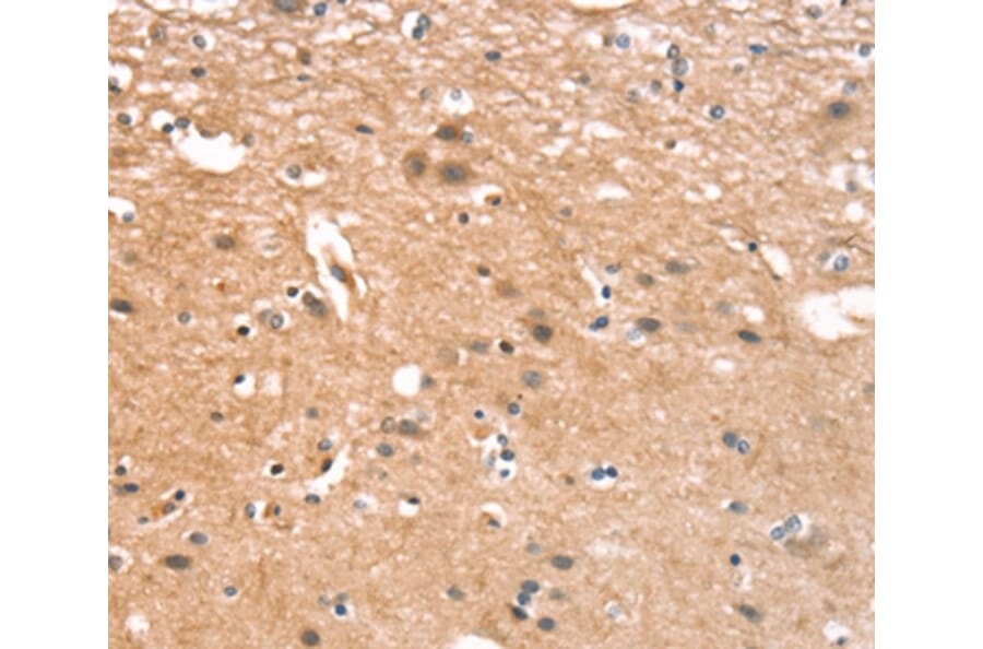 Immunohistochemistry - CYLD Antibody from Signalway Antibody (37514) - Antibodies.com