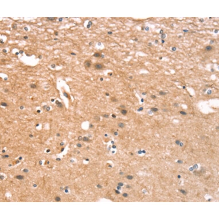 Immunohistochemistry - CYLD Antibody from Signalway Antibody (37514) - Antibodies.com