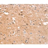 Immunohistochemistry - CYLD Antibody from Signalway Antibody (37514) - Antibodies.com