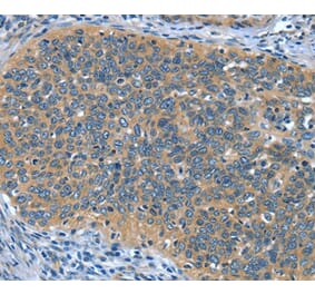 Immunohistochemistry - DTX1 Antibody from Signalway Antibody (37528) - Antibodies.com