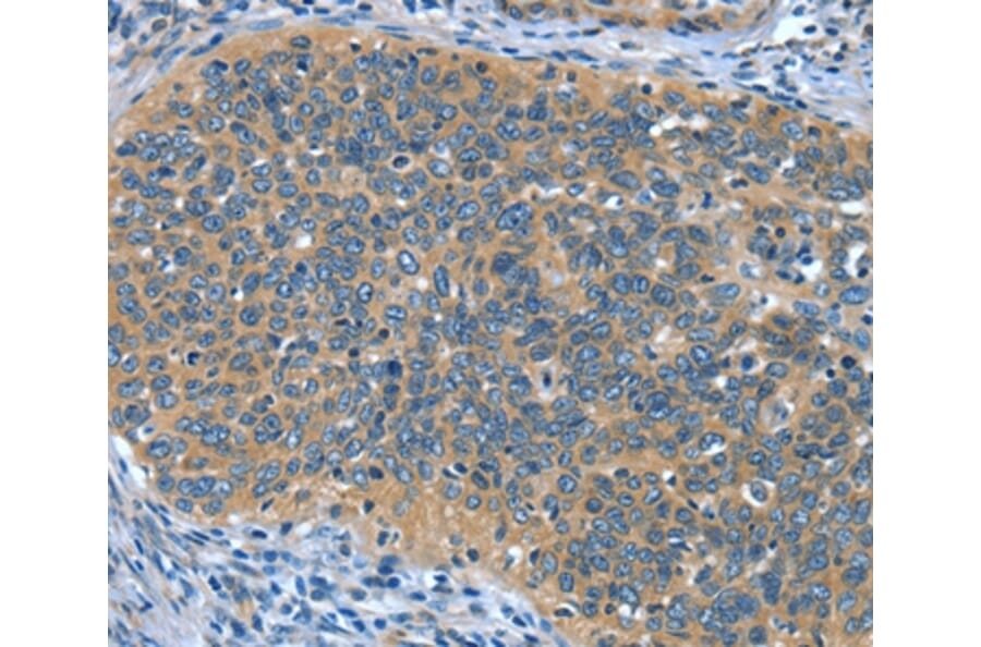 Immunohistochemistry - DTX1 Antibody from Signalway Antibody (37528) - Antibodies.com