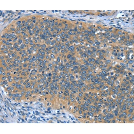 Immunohistochemistry - DTX1 Antibody from Signalway Antibody (37528) - Antibodies.com