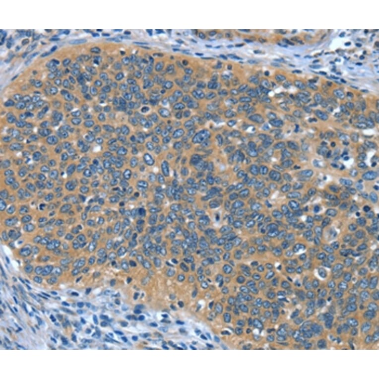 Immunohistochemistry - DTX1 Antibody from Signalway Antibody (37528) - Antibodies.com