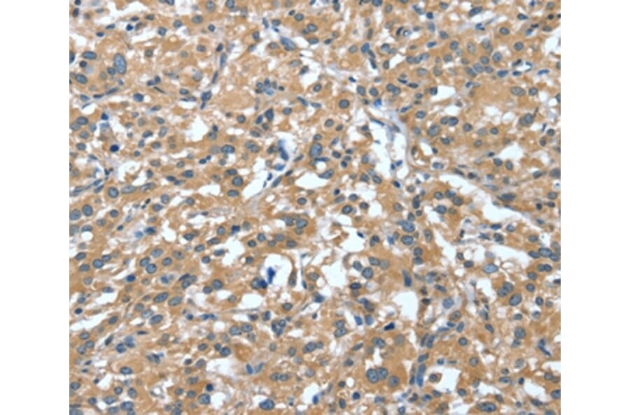 Immunohistochemistry - DTX1 Antibody from Signalway Antibody (37528) - Antibodies.com