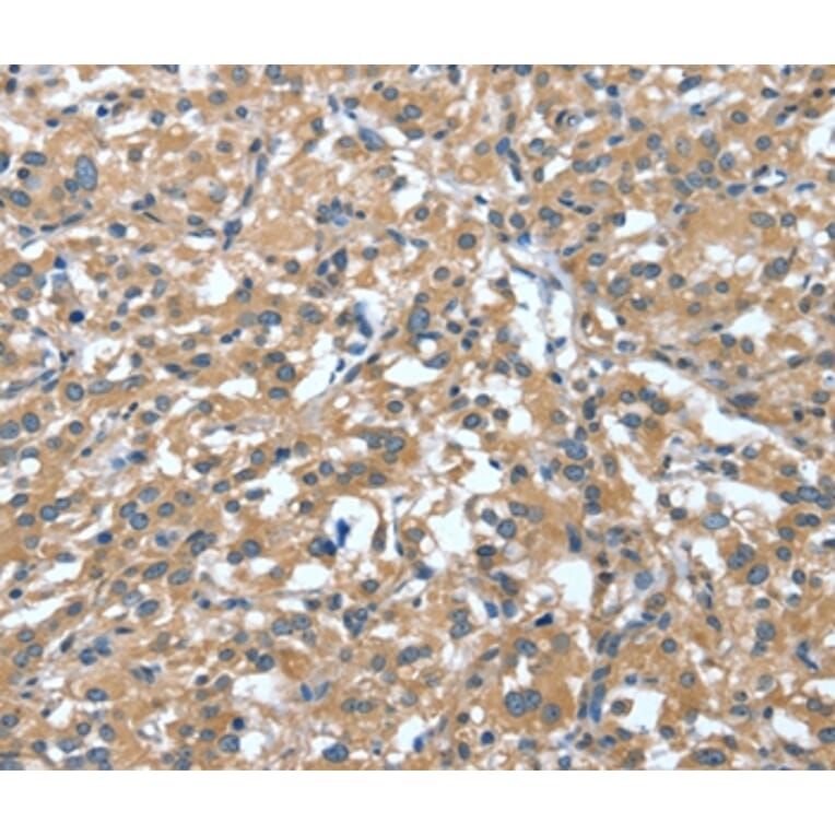Immunohistochemistry - DTX1 Antibody from Signalway Antibody (37528) - Antibodies.com