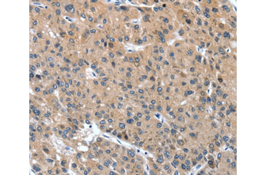 Immunohistochemistry - DSC1 Antibody from Signalway Antibody (37529) - Antibodies.com