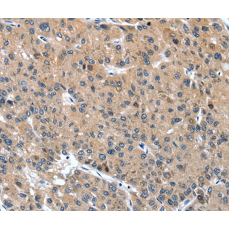Immunohistochemistry - DSC1 Antibody from Signalway Antibody (37529) - Antibodies.com