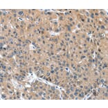 Immunohistochemistry - DSC1 Antibody from Signalway Antibody (37529) - Antibodies.com