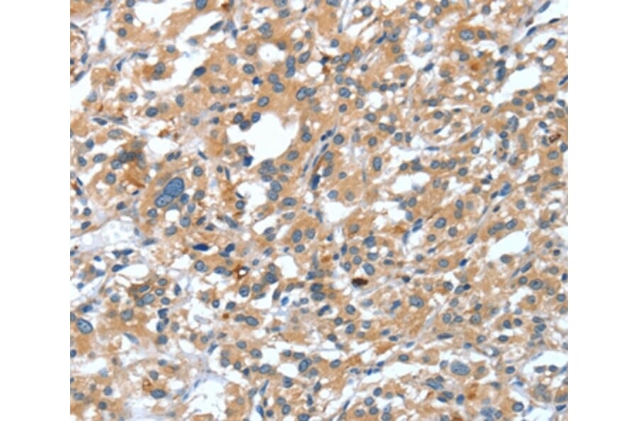 Immunohistochemistry - DSC1 Antibody from Signalway Antibody (37529) - Antibodies.com